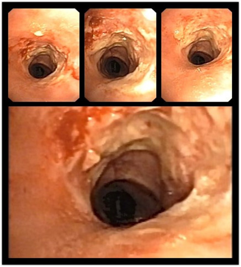 复件图1术后照片_副本