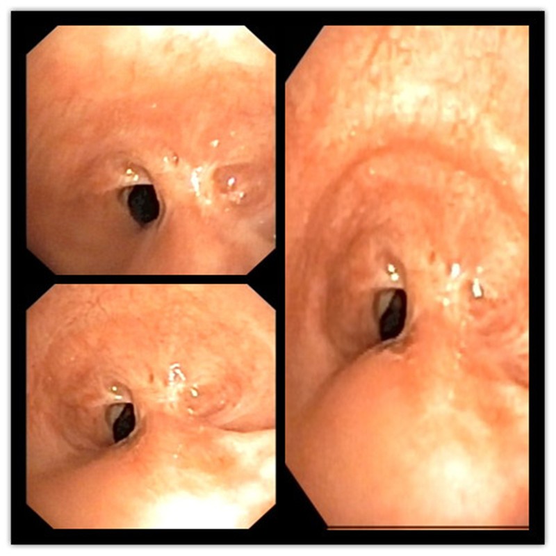 复件图2术前照片_副本