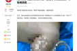 鱼刺扎伤后果严重，学科合作凸显神效