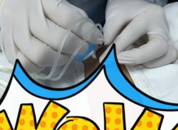 乳腺导管灌注治疗