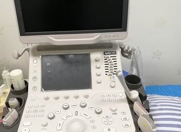 阿波罗500 高端B超机