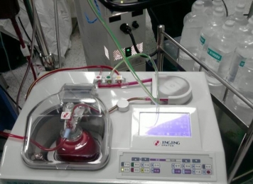 自体血液回收机