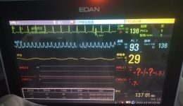 区县两级医院完成生命接力  连夜抢救刀伤心脏破裂患者