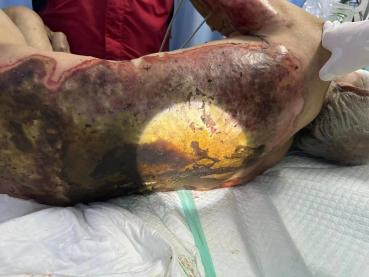 _cgi-bin_mmwebwx-bin_webwxgetmsgimg__&MsgID=762387621731640364&skey=@crypt_4cf2b85f_951fc5bc9ebbf9cc3dfb6565c2a4bc36&mmweb_appid=wx_webfilehelper