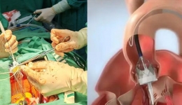 医疗创新里程碑！南溪山医院心外科团队用“黑科技”免缝合瓣膜，守护两位高龄危重患者