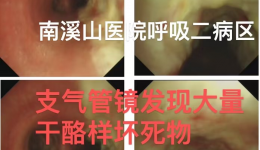 精准诊断除顽疾 多科协作解难题—— 自治区南溪山医院呼吸与危重症医学科成功诊治一例慢性咳嗽病例