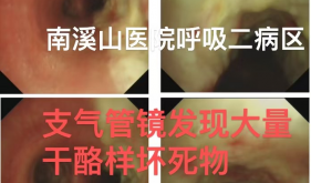 精准诊断除顽疾 多科协作解难题—— 自治区南溪山医院呼吸与危重症医学科成功诊治一例慢性咳嗽病例