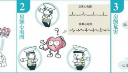 自治区南溪山医院成功完成复杂房颤综合介入治疗案例